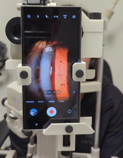 Slit Lamp Phone Mount